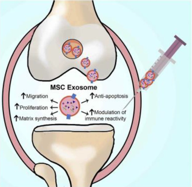 Fig. 1 Therapeutic function of MSC exosomes on cartilage regeneration through multiple facets including the increasing viability of chondrocytes and modulating immune responses.